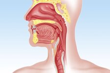 yemek-borusuna-stent-takildiktan-sonra-agir-yuk-kaldirilir-mi-64b64f967fca6.jpg