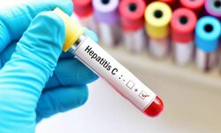 Hepatit C Nedir? Nasıl Bulaşır? Belirtileri Nelerdir?