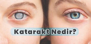 KATARAKT NEDİR ?